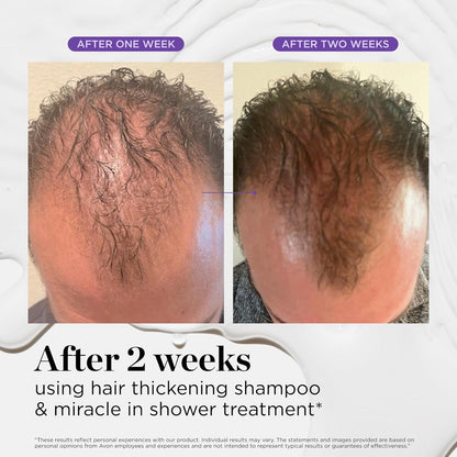 Dr. Groot Miracle in Shower Treatment